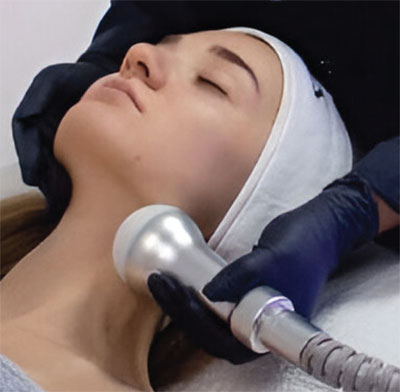 CryoTfusion facial treatment